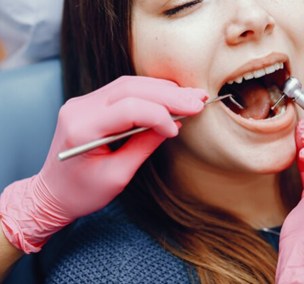 Benefits of Getting a Root Canal Instead of Tooth Extraction
