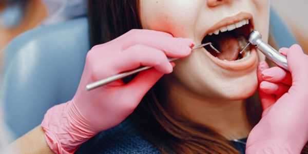 Benefits of Getting a Root Canal Instead of Tooth Extraction